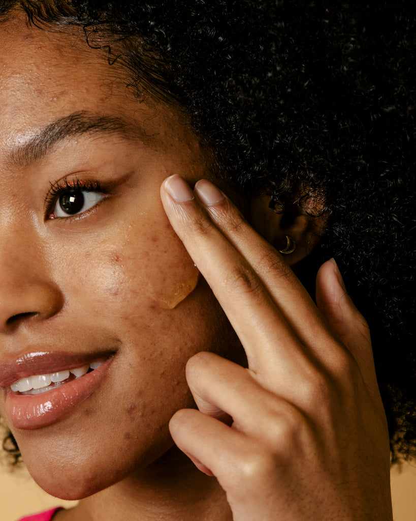 best skincare to fade acne scars and dark spots and hyperpigmentation